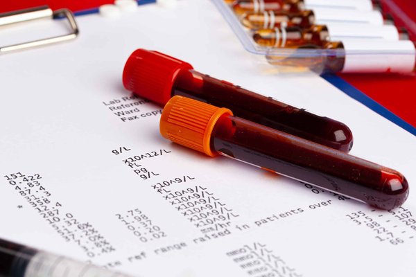 Les avantages méconnus de faire réaliser un diagnostic immobilier en PACA